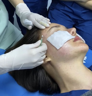깊은 라인 이동 콜라겐 신생 가시가 있는 PDO 스레드