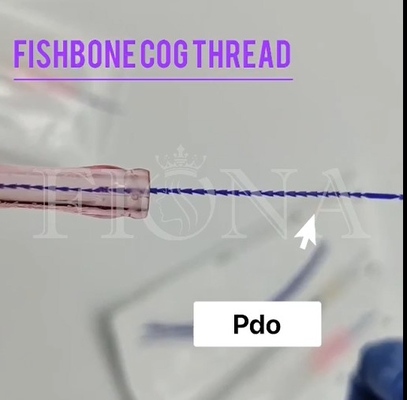 18G100MM을 드는 얼굴 눈 검사 팔을 위한 PDO 생선뼈 조형 장부 실
