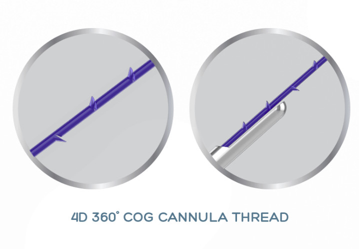 PDO PCL PLLA  4D COG 캔널아 스레드는 비 외과적 표면 상승을 위해 19G-100mm을 높입니다